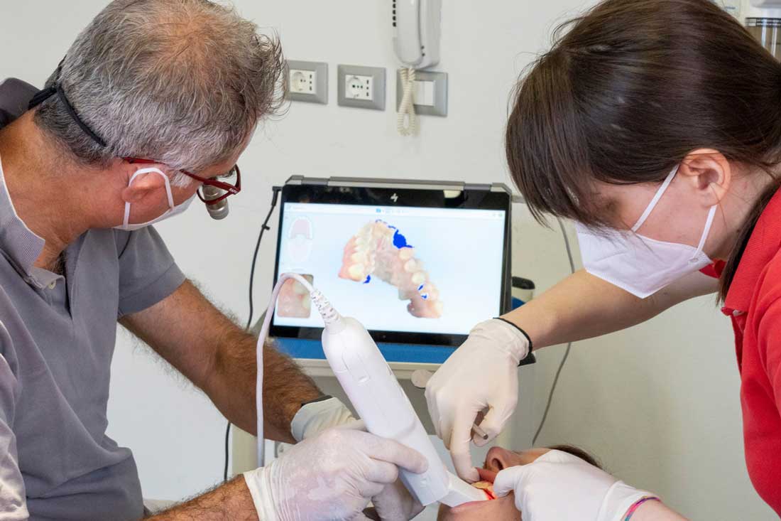 Scanner Ottico iTero per rilevare la dentatura in modo tridimensionale - Rea Sibilla Ferrara